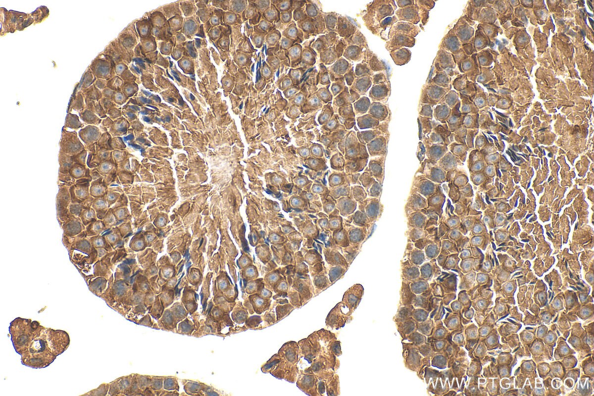 Immunohistochemistry (IHC) staining of mouse testis tissue using ART3 Polyclonal antibody (15930-1-AP)