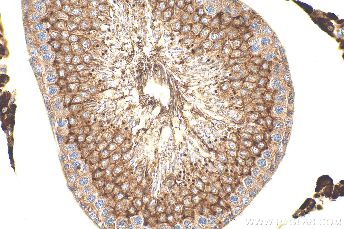 Immunohistochemistry (IHC) staining of rat testis tissue using ART3 Polyclonal antibody (15930-1-AP)