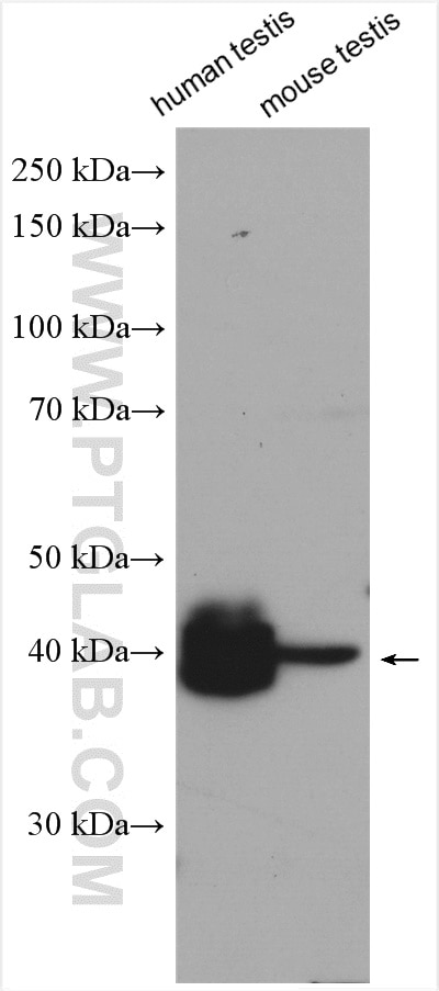 Western Blot (WB) analysis of various lysates using ART3 Polyclonal antibody (15930-1-AP)