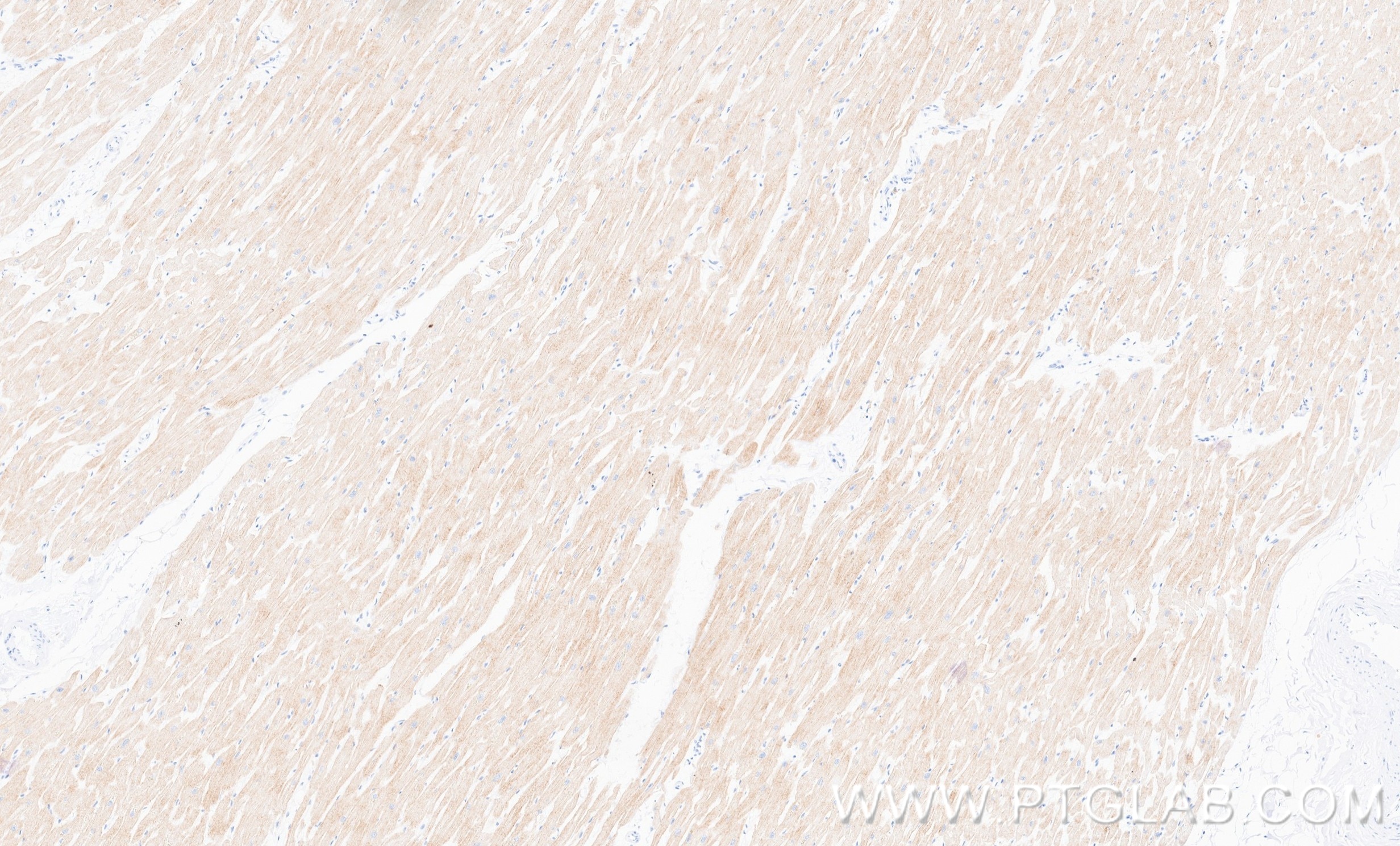 IHC staining of human heart using 87108-1-RR Immunohistochemistry (IHC) staining of human heart tissue using ART3 Recombinant monoclonal antibody (87108-1-RR)