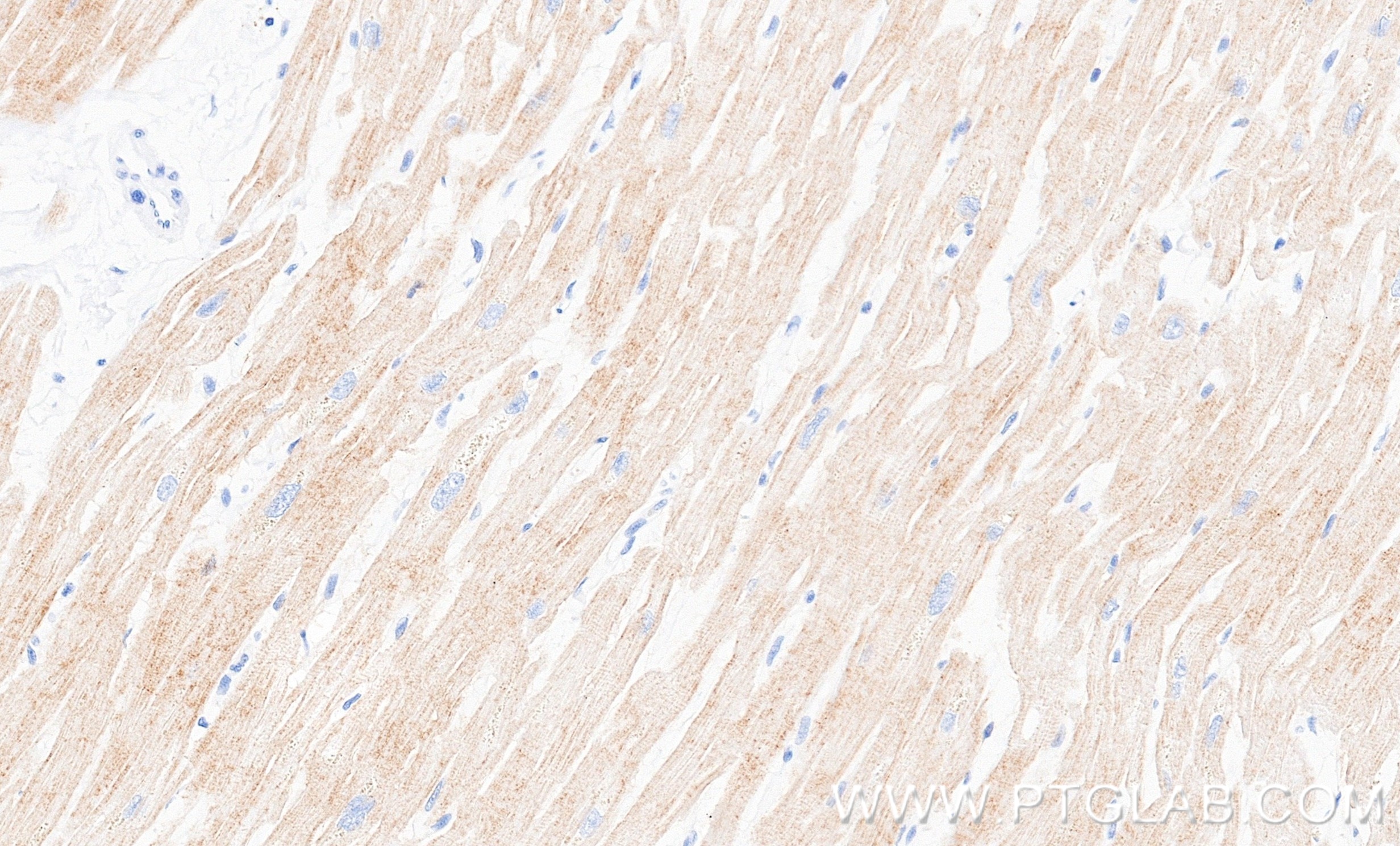 IHC staining of human heart using 87108-1-RR Immunohistochemistry (IHC) staining of human heart tissue using ART3 Recombinant monoclonal antibody (87108-1-RR)