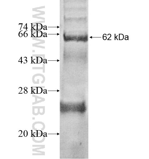 ART4 fusion protein Ag12478 SDS-PAGE