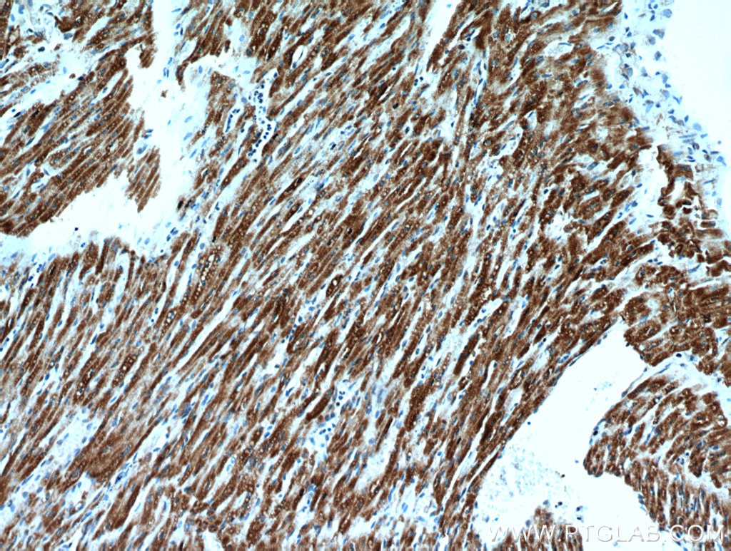 IHC staining of human heart using 11354-1-AP