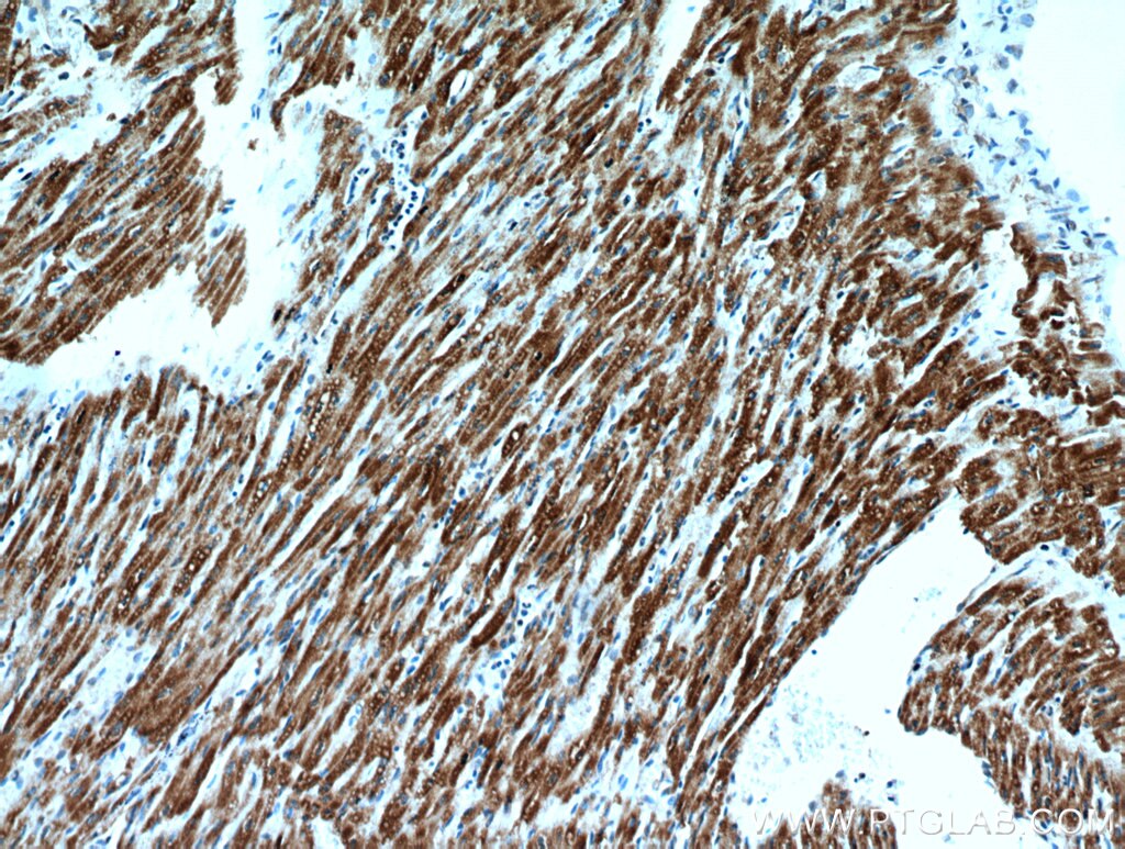 Immunohistochemistry (IHC) staining of human heart tissue using ART5 Polyclonal antibody (11354-1-AP)