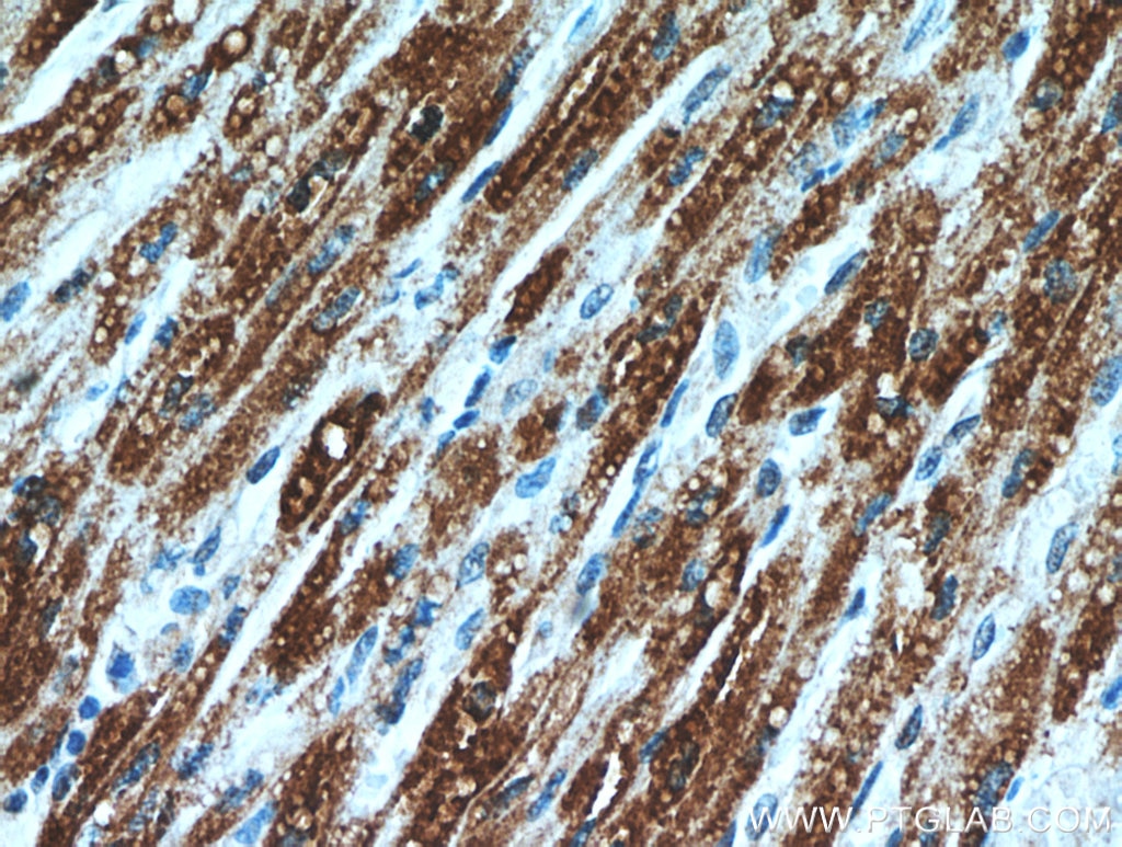 Immunohistochemistry (IHC) staining of human heart tissue using ART5 Polyclonal antibody (11354-1-AP)