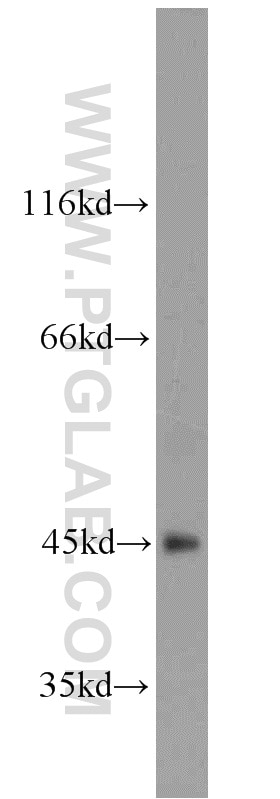 Western Blot (WB) analysis of mouse testis tissue using ART5 Polyclonal antibody (11354-1-AP)
