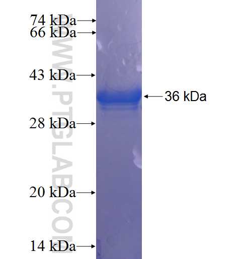 ARVCF fusion protein Ag23172 SDS-PAGE