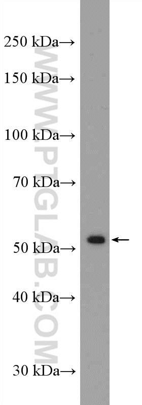 WB analysis of SH-SY5Y using 20739-1-AP