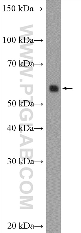 Western Blot (WB) analysis of NIH/3T3 cells using ARX Polyclonal antibody (20739-1-AP)