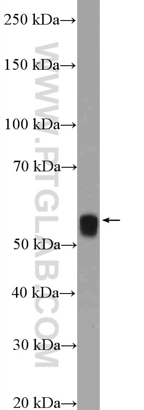 Western Blot (WB) analysis of NIH/3T3 cells using ARX Polyclonal antibody (20739-1-AP)