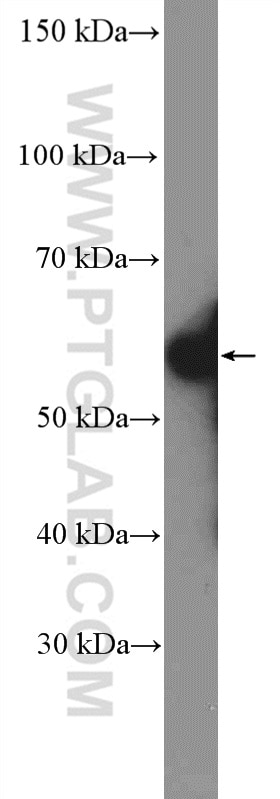 Western Blot (WB) analysis of SH-SY5Y cells using ARX Polyclonal antibody (20739-1-AP)