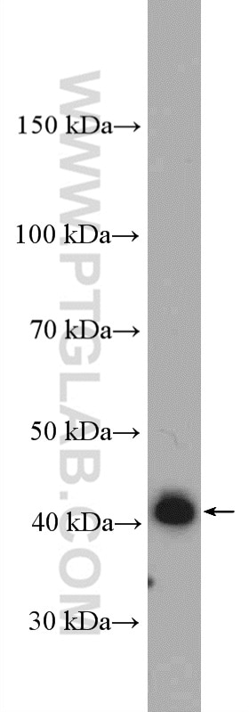 Western Blot (WB) analysis of mouse liver tissue using AS3MT Polyclonal antibody (27270-1-AP)