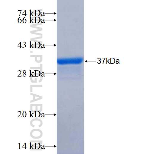 AS3MT fusion protein Ag26194 SDS-PAGE