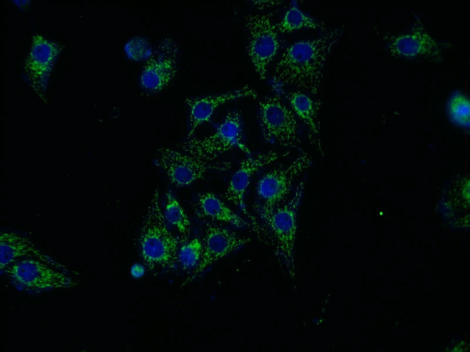 Immunofluorescence (IF) / fluorescent staining of SH-SY5Y cells using ASAH1 Polyclonal antibody (11274-1-AP)