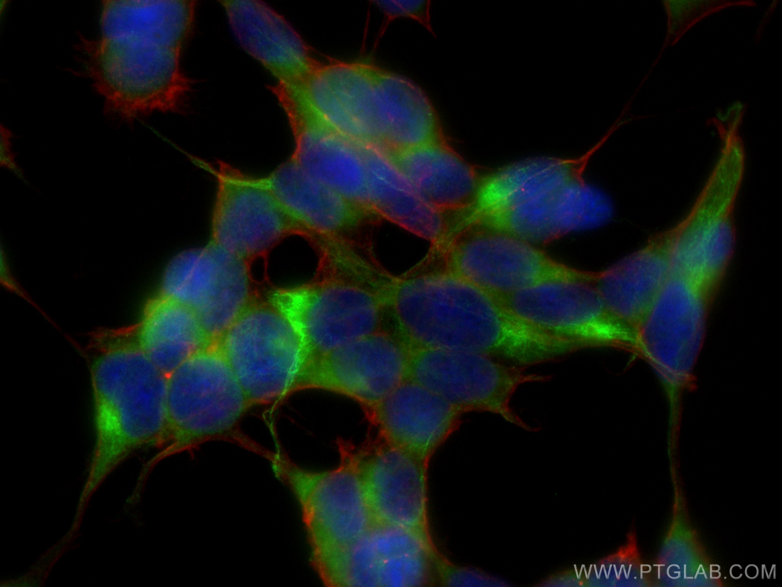Immunofluorescence (IF) / fluorescent staining of SH-SY5Y cells using ASAH1 Polyclonal antibody (11274-1-AP)