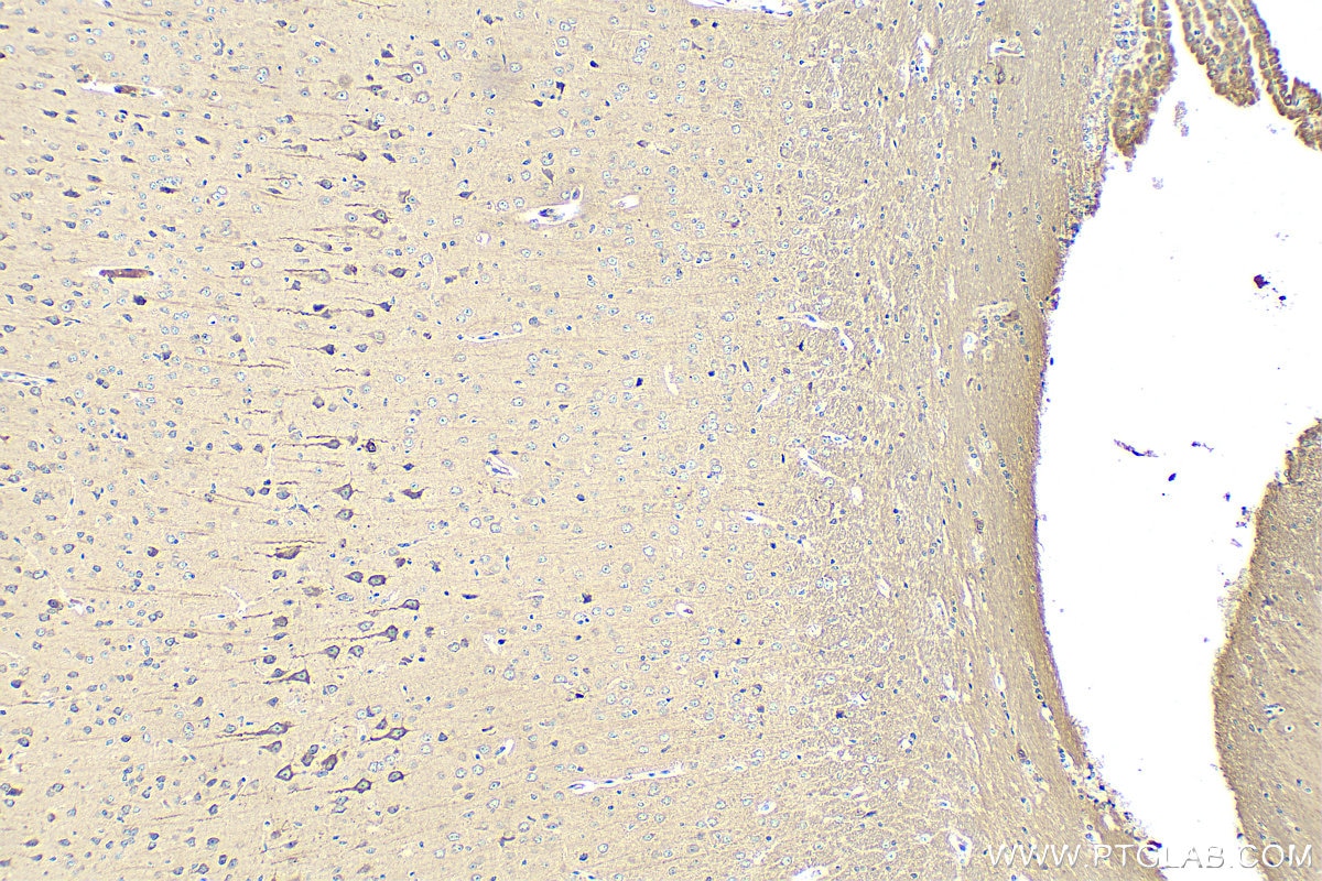 IHC staining of mouse brain using 11274-1-AP