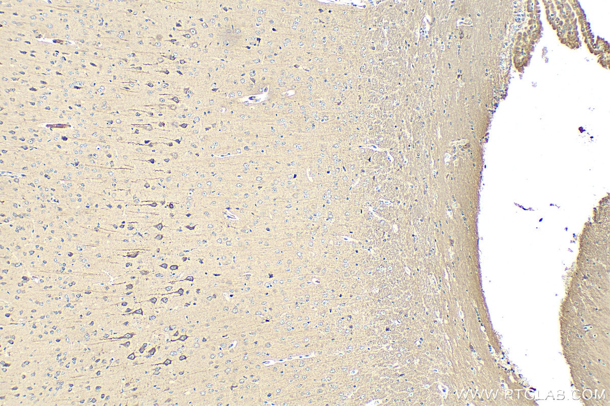 Immunohistochemistry (IHC) staining of mouse brain tissue using ASAH1 Polyclonal antibody (11274-1-AP)