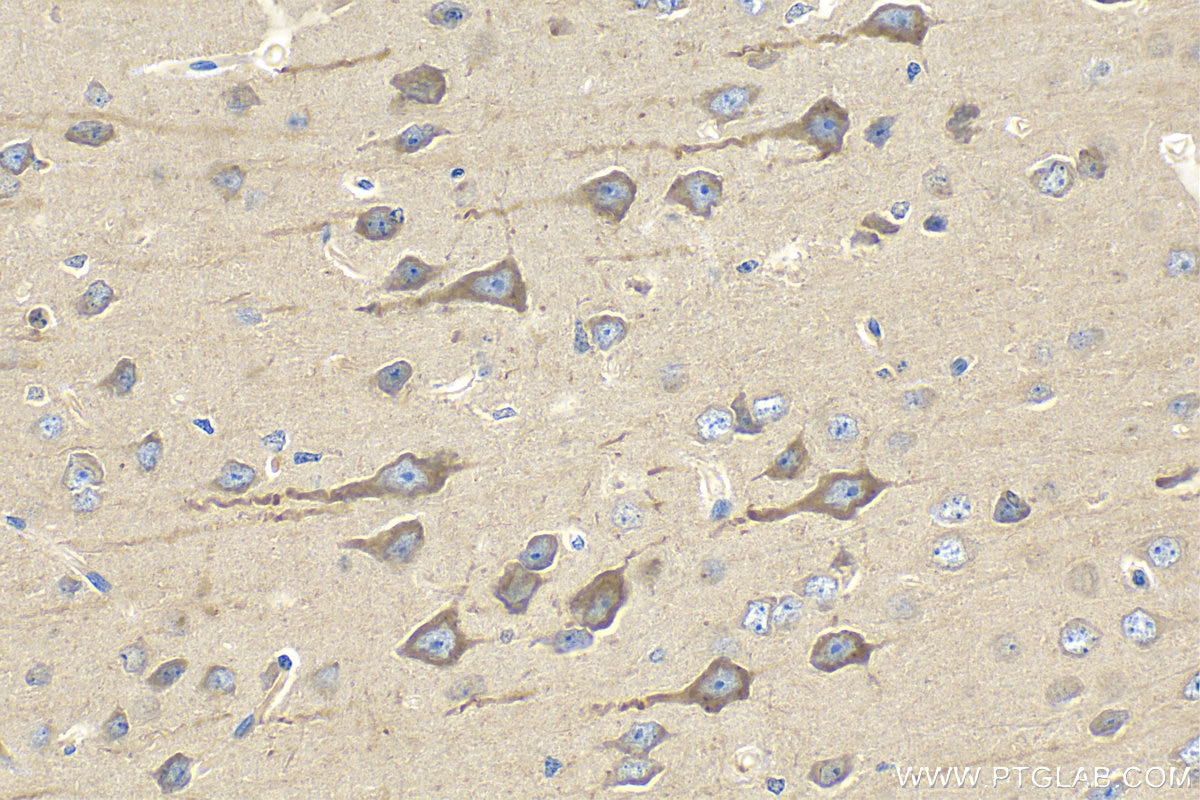 Immunohistochemistry (IHC) staining of mouse brain tissue using ASAH1 Polyclonal antibody (11274-1-AP)