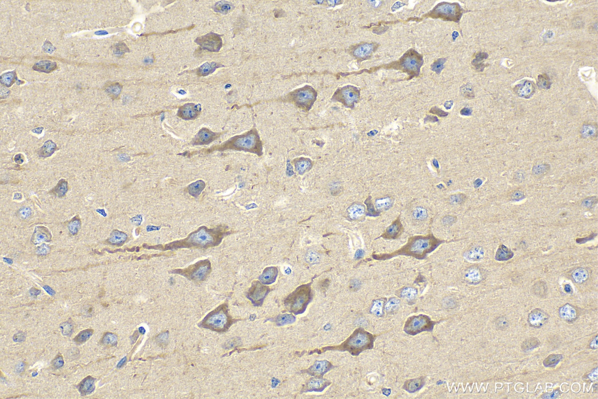 IHC staining of mouse brain using 11274-1-AP