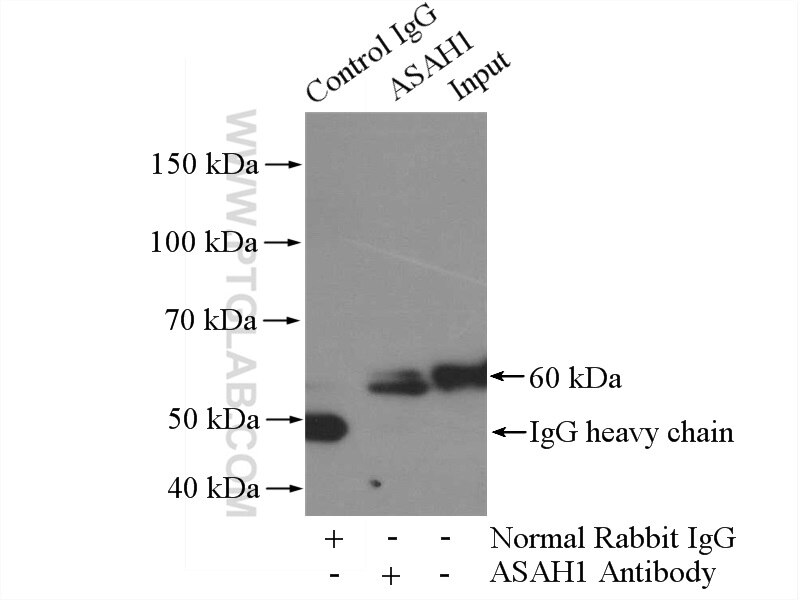 Immunoprecipitation (IP) experiment of mouse brain tissue using ASAH1 Polyclonal antibody (11274-1-AP)