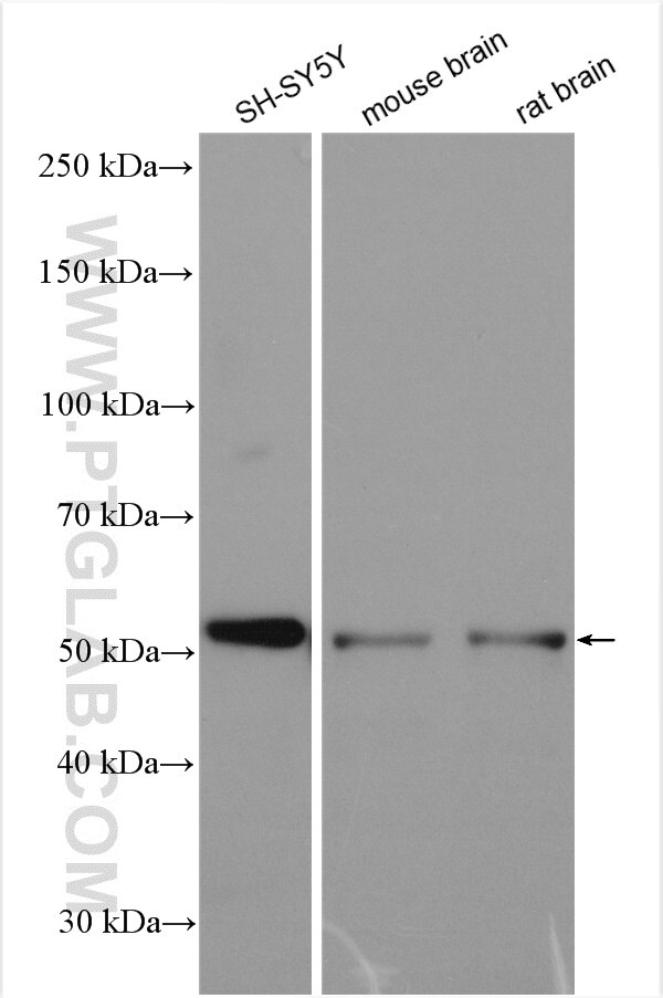 Western Blot (WB) analysis of various lysates using ASAH1 Polyclonal antibody (11274-1-AP)