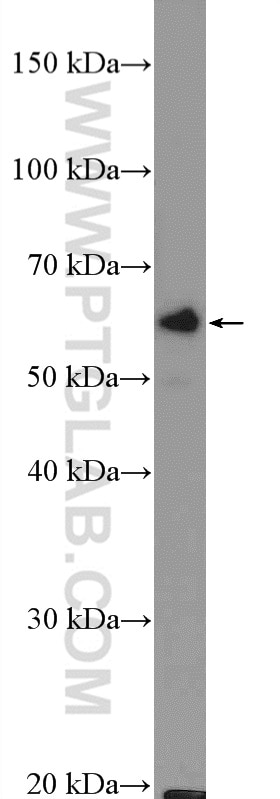 Western Blot (WB) analysis of mouse brain tissue using ASAH1 Polyclonal antibody (11274-1-AP)