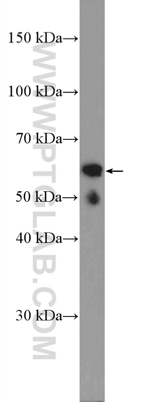 Western Blot (WB) analysis of mouse heart tissue using ASAH1 Polyclonal antibody (11274-1-AP)