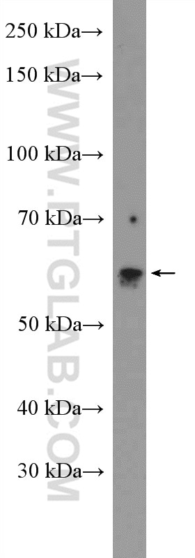 Western Blot (WB) analysis of rat lung tissue using ASAH1 Polyclonal antibody (11274-1-AP)