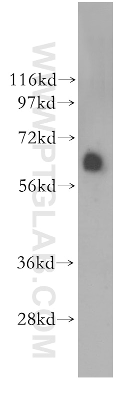 Western Blot (WB) analysis of human lung tissue using ASAH1 Polyclonal antibody (11274-1-AP)