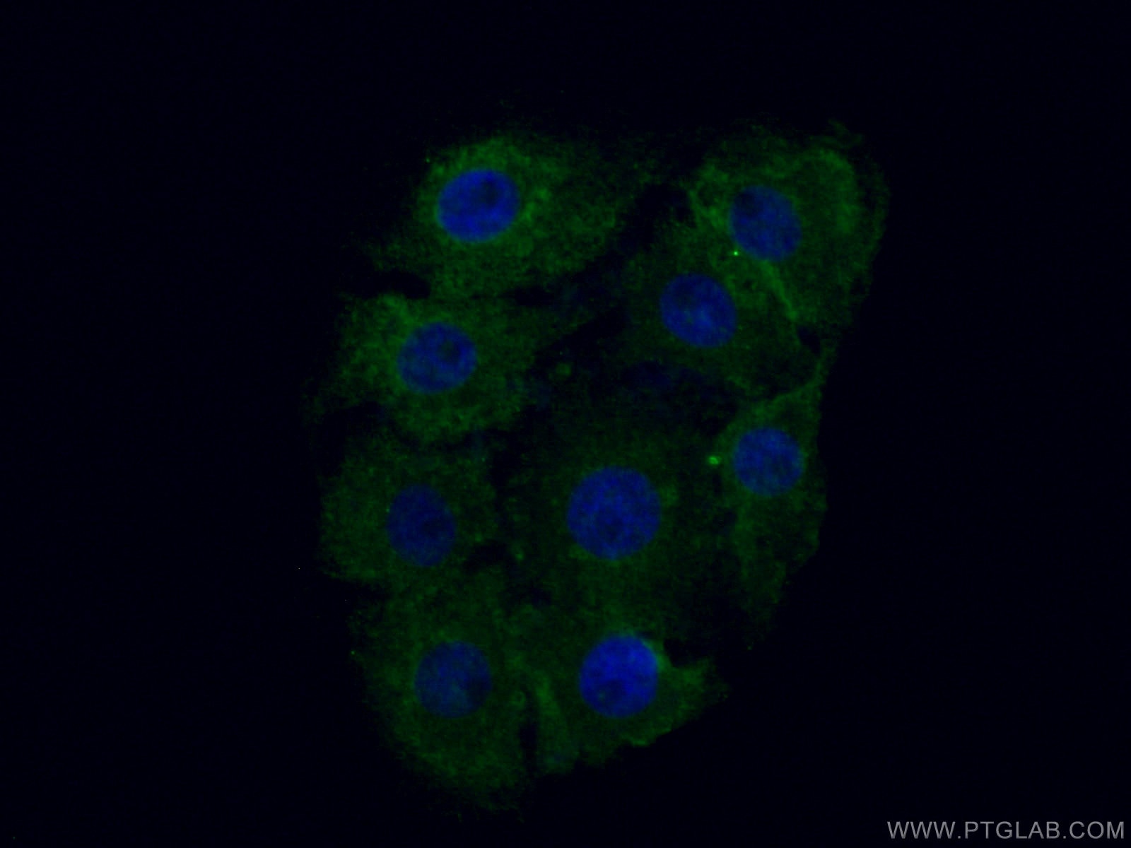 Immunofluorescence (IF) / fluorescent staining of SH-SY5Y cells using ASAH1 Monoclonal antibody (67092-1-Ig)