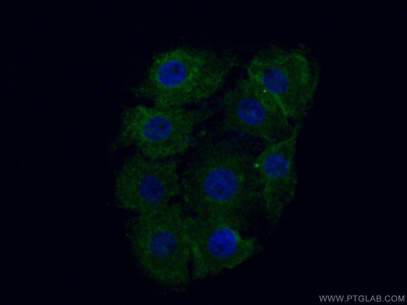 IF Staining of SH-SY5Y using 67092-1-Ig