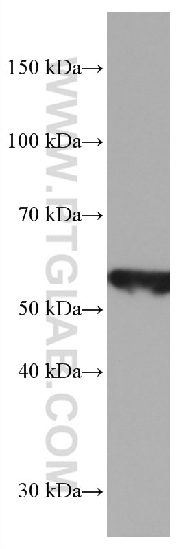 Western Blot (WB) analysis of rat brain tissue using ASAH1 Monoclonal antibody (67092-1-Ig)