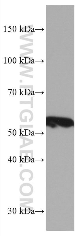 Western Blot (WB) analysis of mouse brain tissue using ASAH1 Monoclonal antibody (67092-1-Ig)