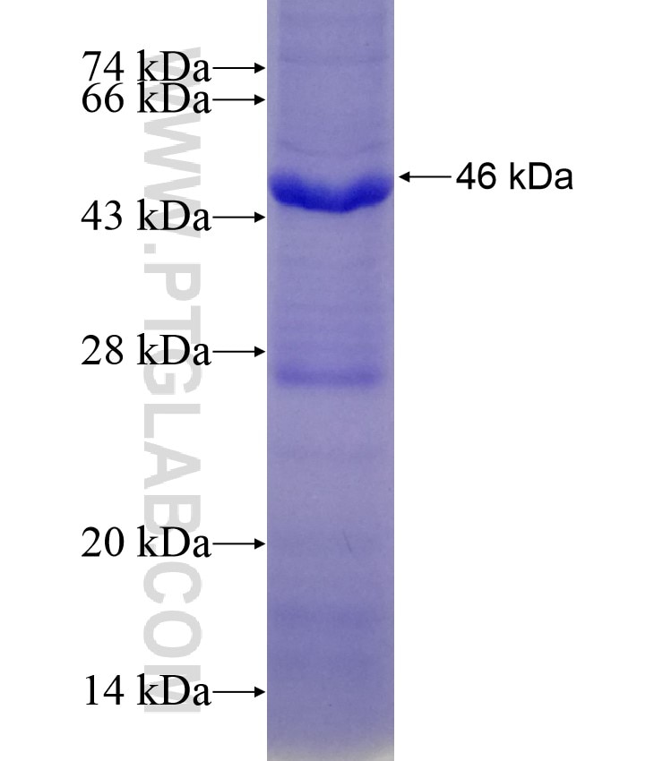 ASAH1 fusion protein Ag28645 SDS-PAGE