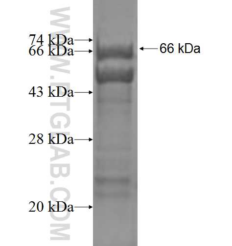 ASAH1 fusion protein Ag1799 SDS-PAGE