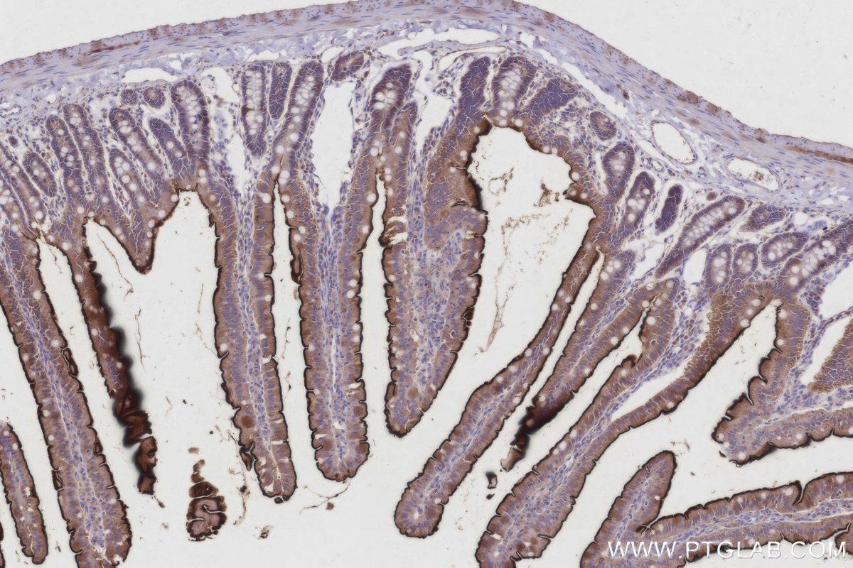 Immunohistochemistry (IHC) staining of rat small intestine tissue using ASAH2 Polyclonal antibody (27742-1-AP)