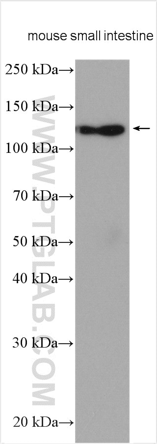 Western Blot (WB) analysis of various lysates using ASAH2 Polyclonal antibody (27742-1-AP)