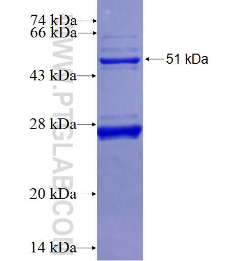 ASAH2 fusion protein Ag26908 SDS-PAGE