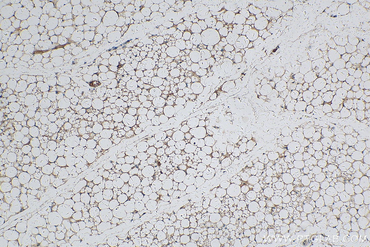 Immunohistochemistry (IHC) staining of mouse brown adipose tissue using CLMP Polyclonal antibody (16127-1-AP)