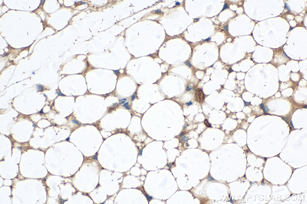 Immunohistochemistry (IHC) staining of mouse brown adipose tissue using CLMP Polyclonal antibody (16127-1-AP)