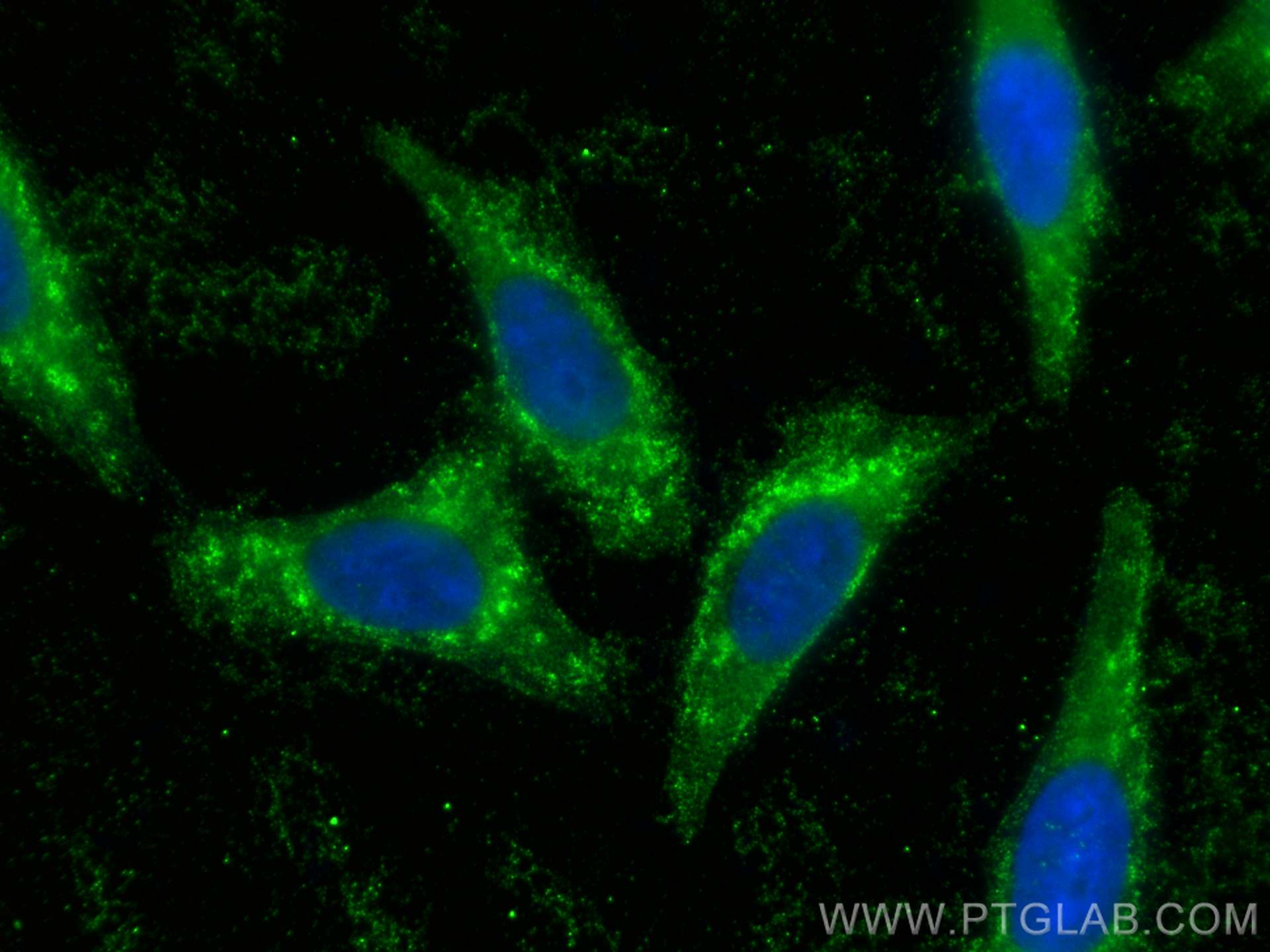 Immunofluorescence (IF) / fluorescent staining of HepG2 cells using ASAP3 Polyclonal antibody (14099-1-AP)