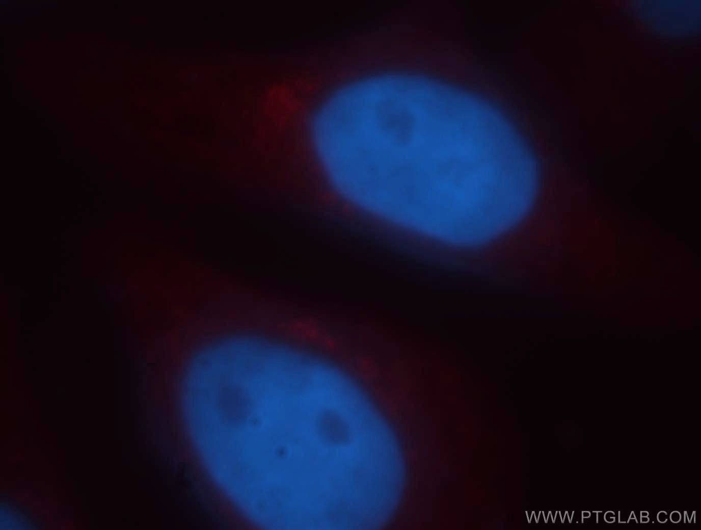 Immunofluorescence (IF) / fluorescent staining of HepG2 cells using ASAP3 Polyclonal antibody (14099-1-AP)
