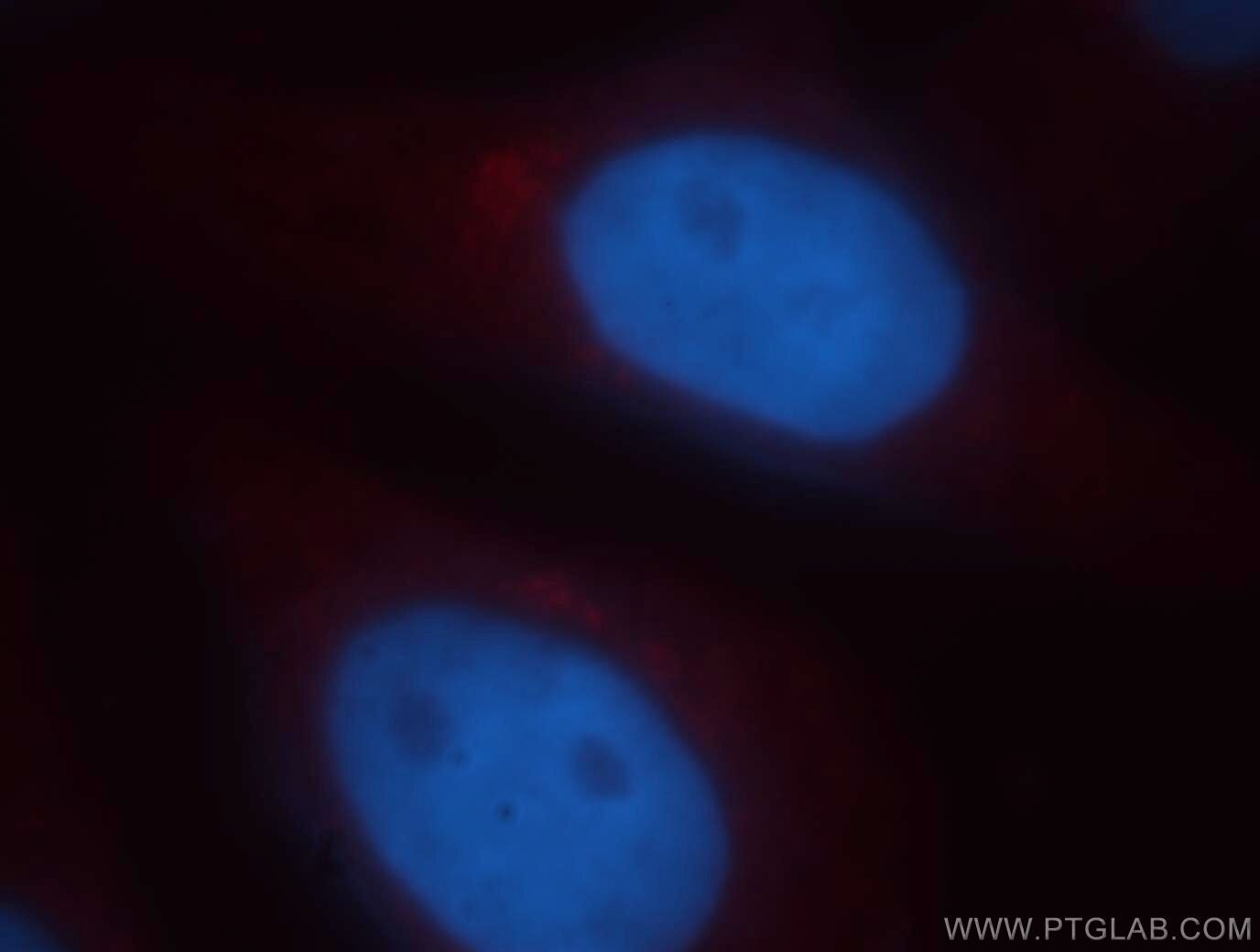 IF Staining of HepG2 using 14099-1-AP