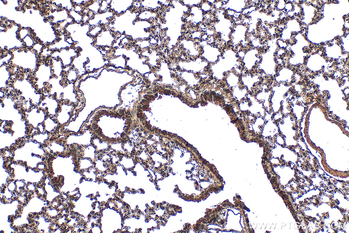 Immunohistochemistry (IHC) staining of mouse lung tissue using ASAP3 Polyclonal antibody (14099-1-AP)