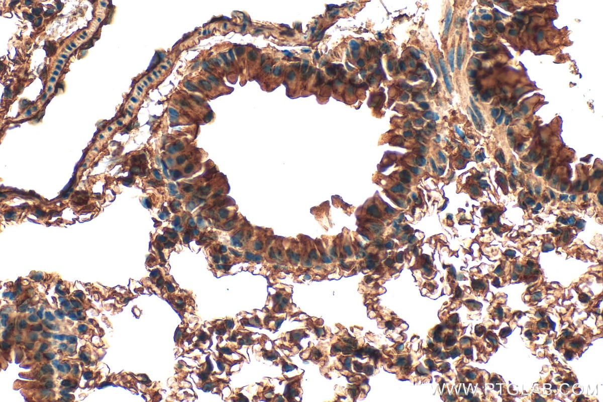 IHC staining of mouse lung using 14099-1-AP