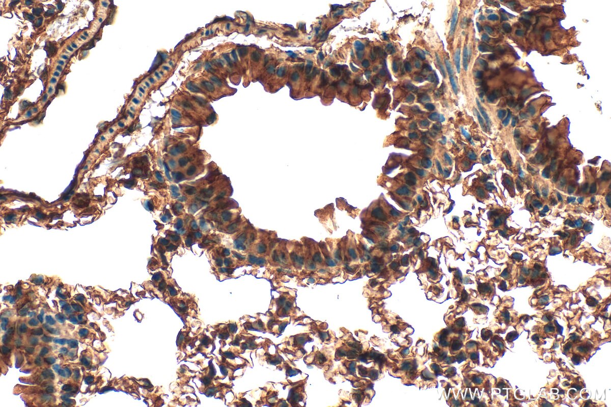 Immunohistochemistry (IHC) staining of mouse lung tissue using ASAP3 Polyclonal antibody (14099-1-AP)