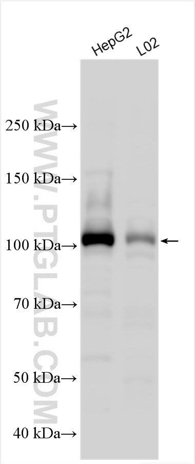 Western Blot (WB) analysis of various lysates using ASAP3 Polyclonal antibody (14099-1-AP)