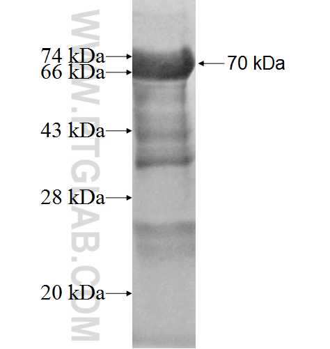 ASAP3 fusion protein Ag5231 SDS-PAGE