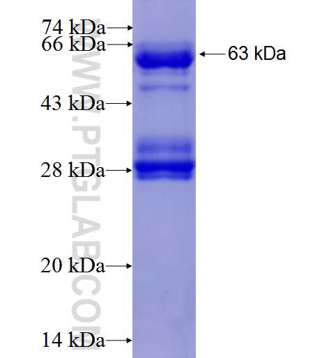 ASB1 fusion protein Ag8859 SDS-PAGE