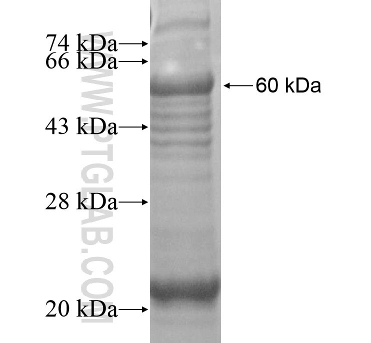 ASB11 fusion protein Ag16399 SDS-PAGE ASB11 fusion protein Ag16399 SDS-PAGE